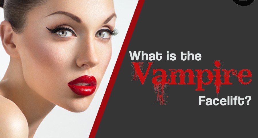 what is the vampire facelift