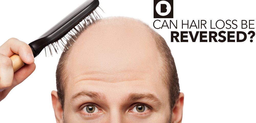 can hair loss be reversed
