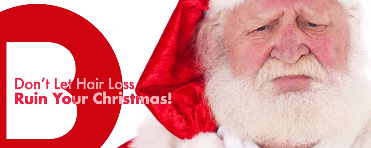 dont let hair loss ruin your christmas